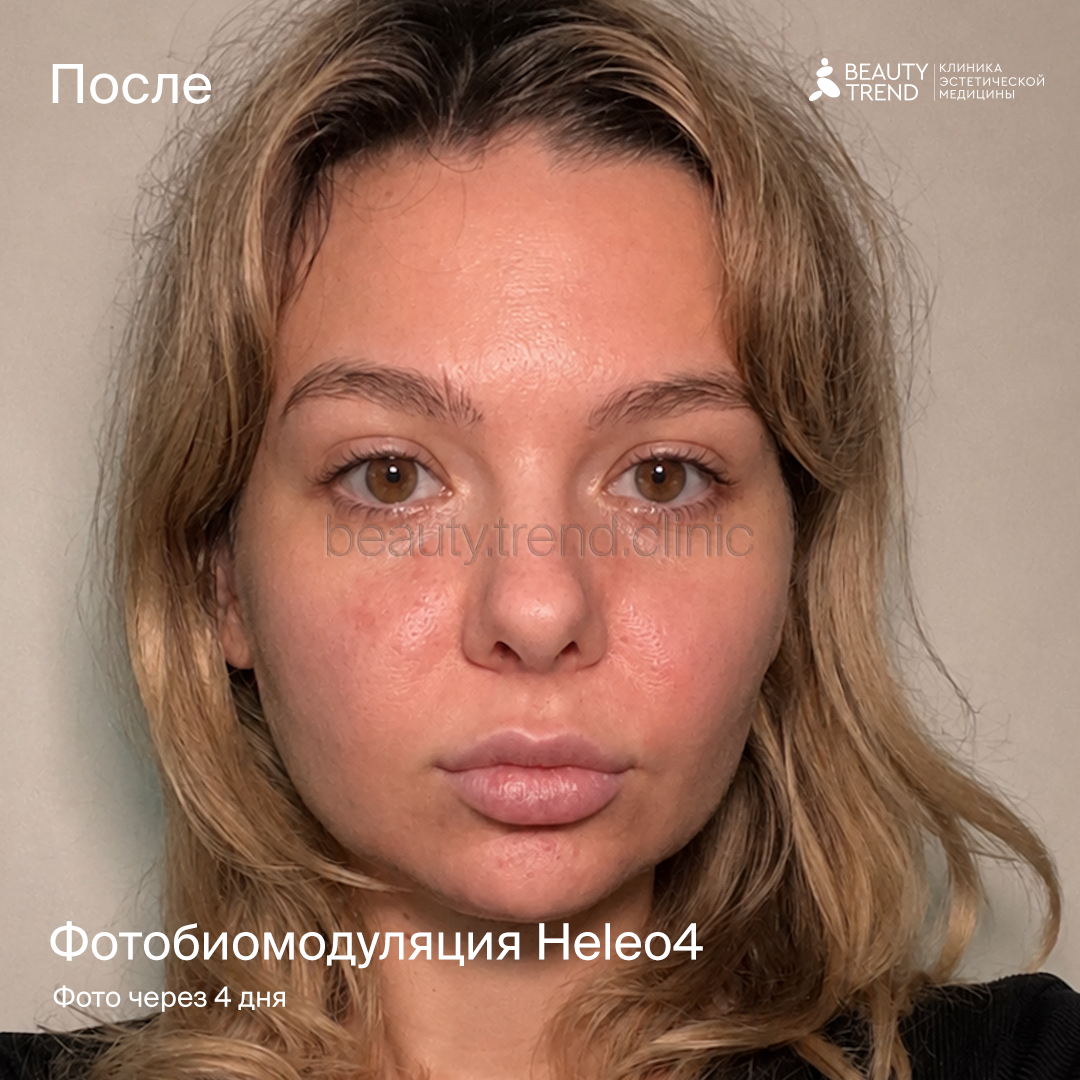 HELEO4 - после 1